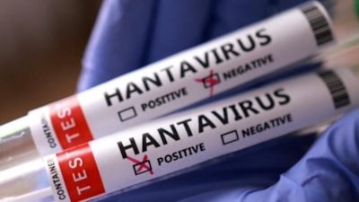 Hantavirüs: ABD, Kore’de buldu, dünyaya yaydı