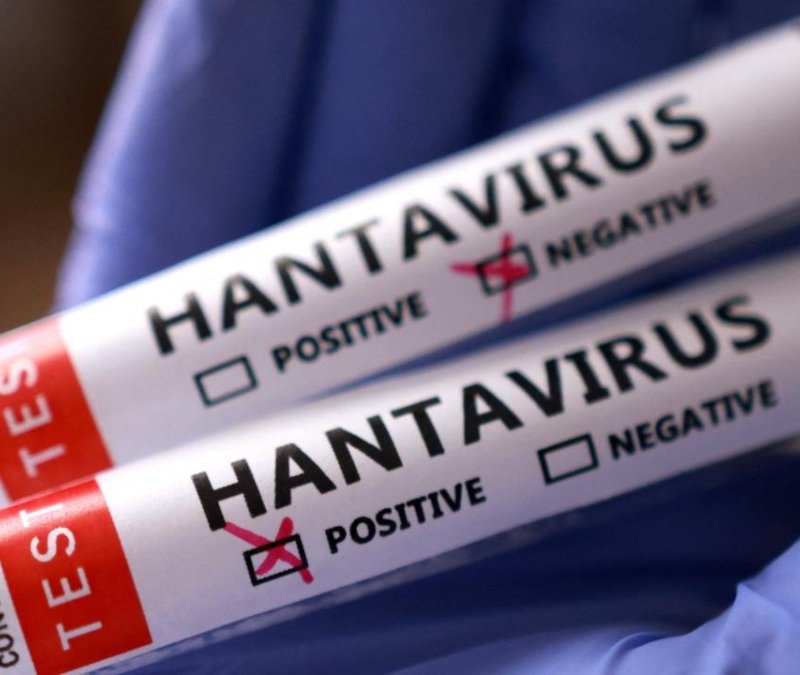 Hantavirüs: ABD Kore’de buldu, dünyaya yaydı