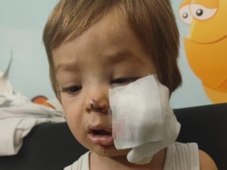 Ankara'da iki çocuğu pitbull saldırısına uğrayan Baba: Kadın tutuksuz yargılanıp çıktı