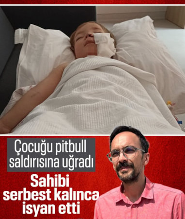 Ankara'da iki çocuğu pitbull saldırısına uğrayan baba: Kadın tutuksuz yargılanıp çıktı