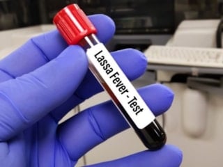 Lassa ateşi nedir, belirtileri nelerdir? Lassa ateşi nasıl geçer?