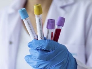 EMA: Hantavirüsün onaylı tedavisi ve aşısı yok