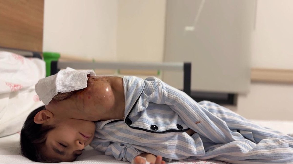 Gaziantep'te 8 yaşındaki kızın boynundan 3 kiloluk kitle çıkarıldı