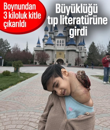 Gaziantep'te 8 yaşındaki kızın boynundan 3 kiloluk kitle çıkarıldı