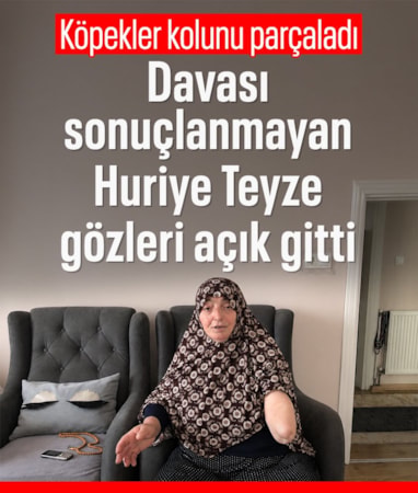 Trabzon'da köpekler tarafından kolu parçalanan kadın, davasının sonuçlandığını göremeden hayatını kaybetti