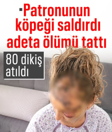 İzmir'de patronunun köpeği ölümün kıyısına getirdi: Vücuduna 80 dikiş atıldı
