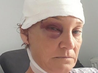 İzmir’de patronun köpeği tarafından saldırıya uğrayan kadın, davacı oldu