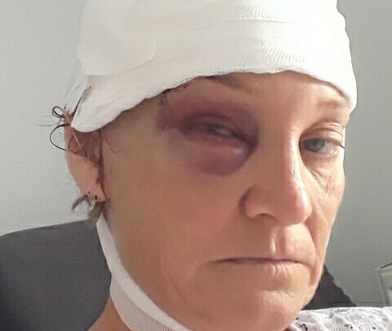 İzmir’de patronun köpeği tarafından saldırıya uğrayan kadın, davacı oldu