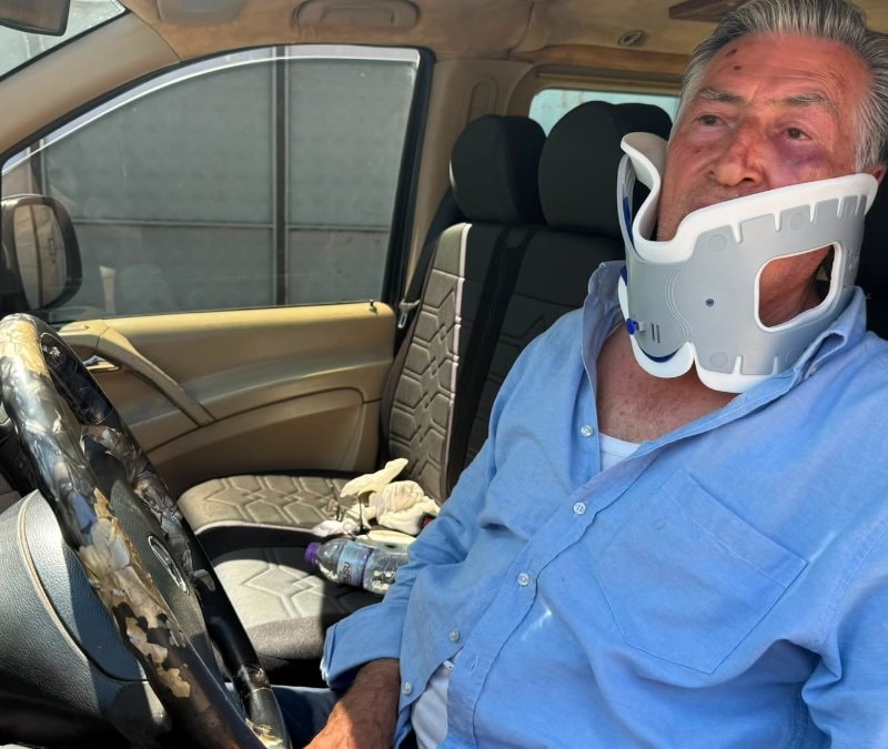 Antalya’da VIP transfer şoförüne boksör saldırısı: 70 kilometre hızla giderken yumrukladı