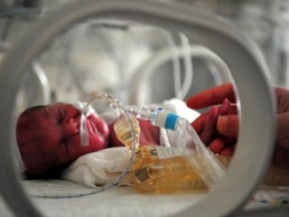 İstanbul'da 17 günlük bebek kuvözde yandı: 4 sağlık çalışanına soruşturma izni