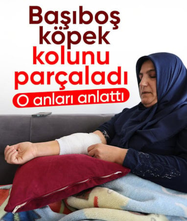 Elazığ’da başıboş köpek saldırısına uğrayan kadın, o anları anlattı