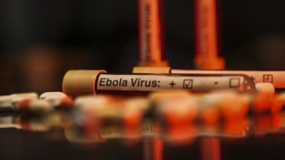 Kenya, ABD'nin ebola karantina tesisi kurmasına izin verdi