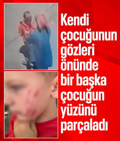 Van'da sokakta dehşet anları: Küçük çocuğun yüzünü parçaladı