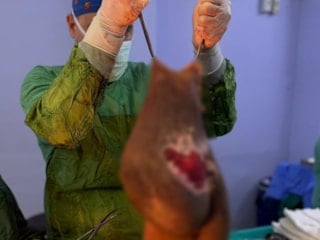 Aydın'da yaşayan kadının karnından 40 kilogram kitle çıkarıldı