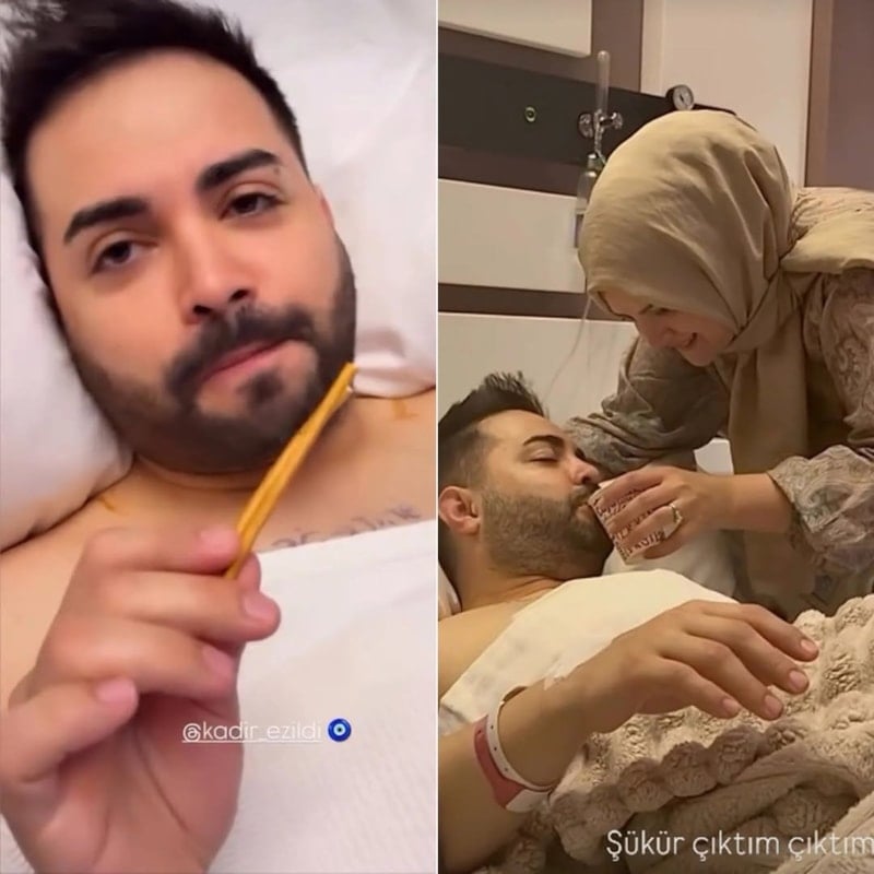 Kadir Ezildi Saç Ektirme İçin Hazırlandığını Açıkladı ve Yeni Adımlar Atıyor