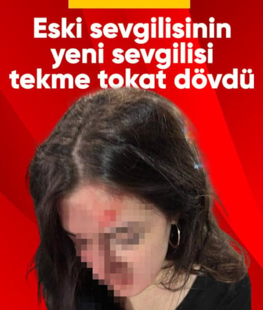 Samsun'da eski sevgilisinin kız arkadaşı tarafından dövüldü
