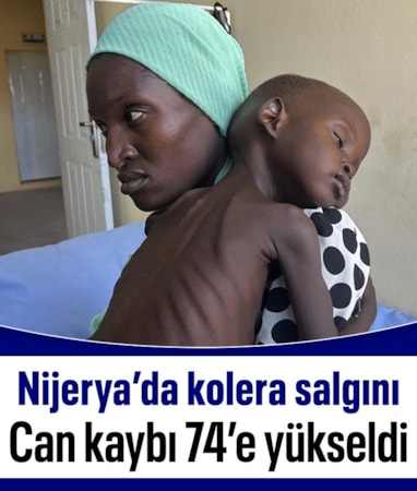 Nijerya'da kolera salgınında can kaybı 74'e çıktı