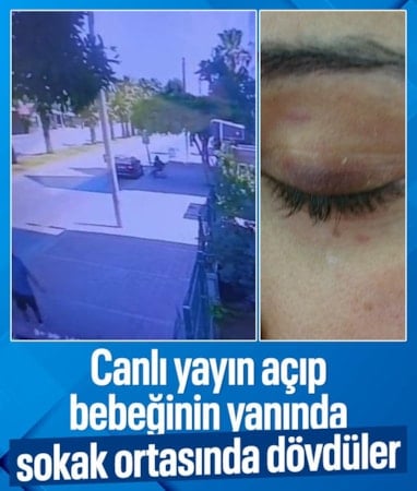 Antalya'da 6 kadının saldırısına uğrayan anne konuştu