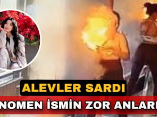 Çantadaki powerbank patladı: Genç influencer alevler içinde kaldı
