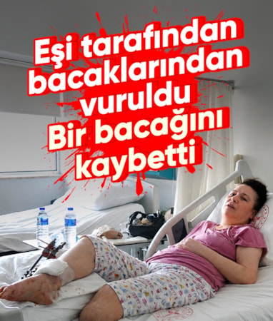 Muğla'da boşanma aşamasındaki eşi tarafından vurulan kadın bir bacağını kaybetti