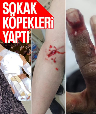 Şırnak'ta başıboş köpeklerin saldırdığı kadınlar hastanelik oldu