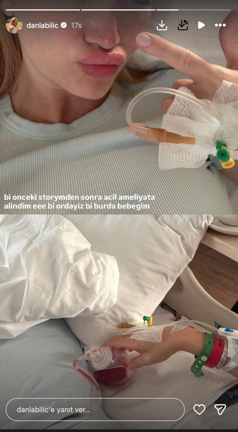 Aquafilling Krizi: Danla Bilic'in Yaşadığı Komplikasyonlar ve Son Gelişmeler