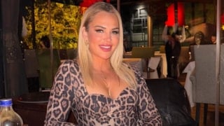 Survivor 2026 ikinci olmuştu! Nagihan Karadere estetik yaptırdı