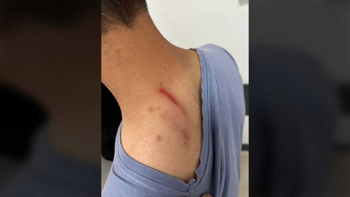 Hastanede tıbbi sekretere saldırı