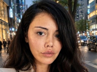 Kore'de yüz nakli yaptırmıştı! Didem Ceran gelen yorumlara isyane etti