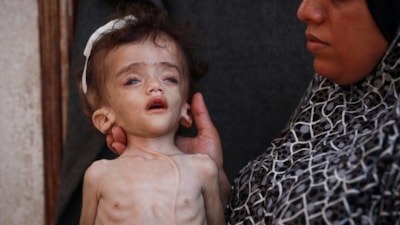 Gazze'de çocuklar ölmeye devam ediyor