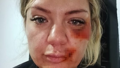Antalya'da eski sevgili dehşeti: Kırılan bıçakla vurmaya devam etti