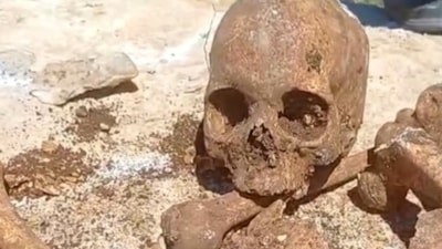 Malatya'da inşaat kazısından insan kemikleri çıktı