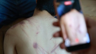 Elazığ'da down sendromlu çocuğa şiddet iddiası: Aile suç duyurusunda bulundu