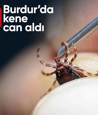 Burdur'da vücuduna kene tutunan kadın hayatını kaybetti