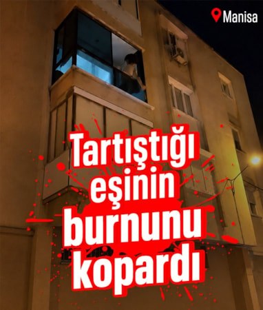 Manisa'da tartıştığı eşinin burnunu ısırıp kopardı