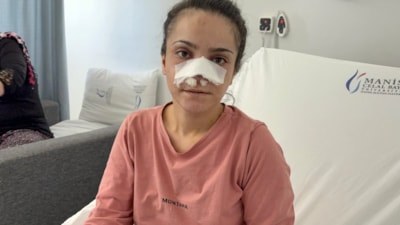 Manisa'da eşinin kopardığı burnu başarılı operasyonla yerine dikildi