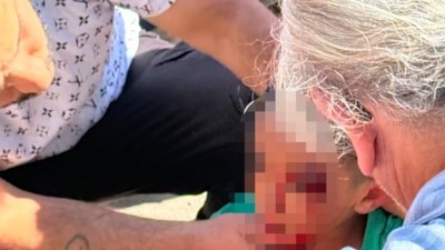 Eskişehir'de otobüsün çarptığı çocuk yaralandı