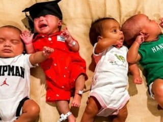 Avustralya'da tek yumurta dördüzleri dünyaya geldi