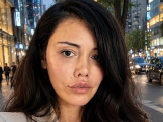 Yüz nakil ameliyatı olmuştu! Didem Ceran hastane tarafından sokağa atıldı