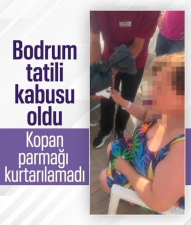 Muğla tatilinde şezlong faciası: Kopan parmağı kurtarılamadı