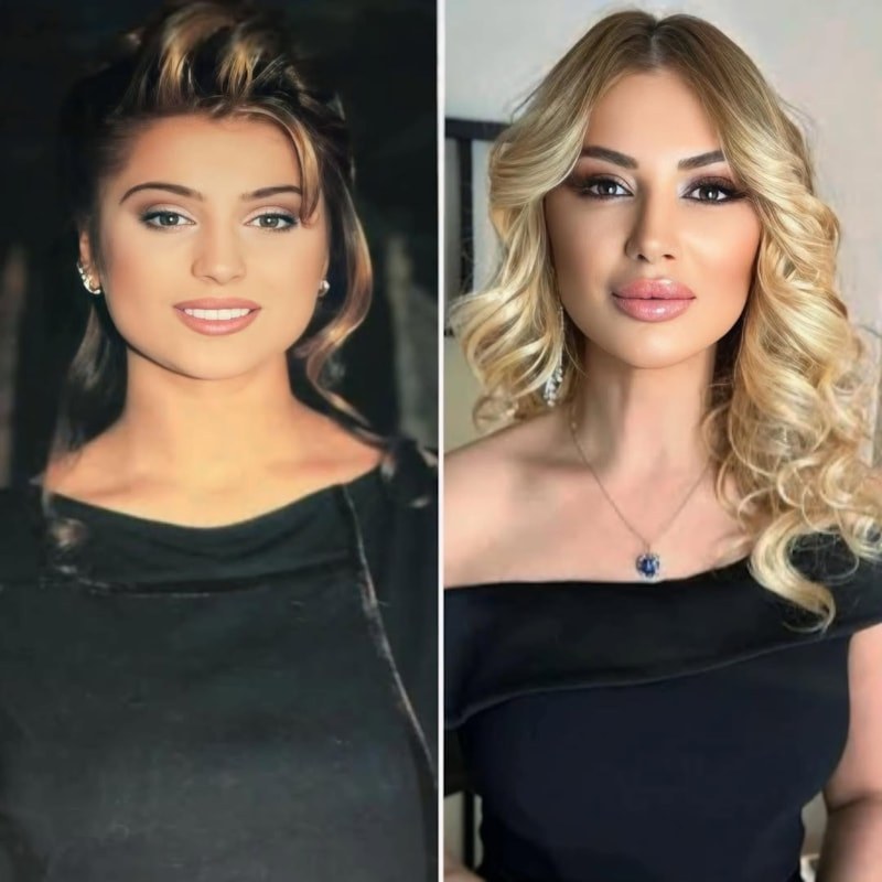 Songül Karlı'nın Oğlu Efe Furkan Gümüş'ün Büyüyen Değişimi ve Sosyal Medya Tepkileri