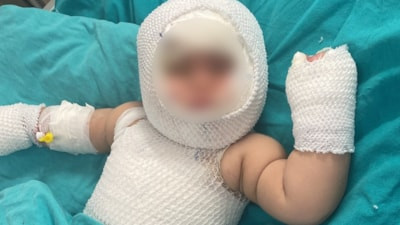 Mersin'de domates konservesi patladı: 9 aylık bebek ağır yaralandı