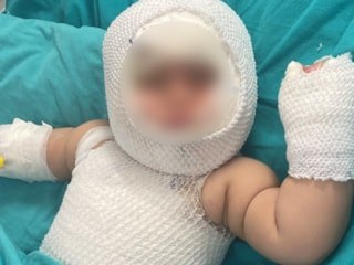 Mersin'de domates konservesi patladı: 9 aylık bebek ağır yaralandı