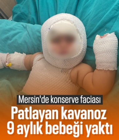 Mersin'de domates konservesi patladı: 9 aylık bebek ağır yaralandı