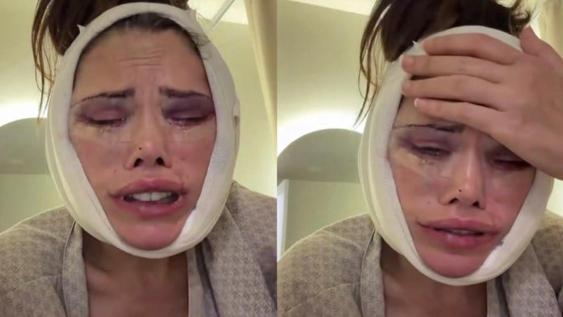 Didem Ceran'ın Kore Gerdirme Serüveni ve Kim Kardashiansestetiği Tartışması