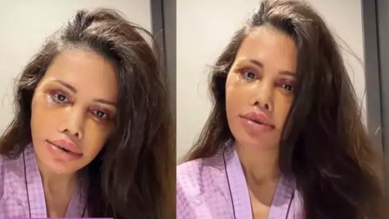 Didem Ceran'ın Kore Gerdirme Serüveni ve Kim Kardashiansestetiği Tartışması