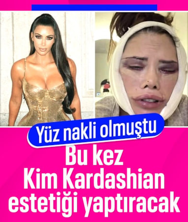 Didem Ceran'dan yeni operasyon açıklaması: Kim Kardashian estetiği yaptıracağım