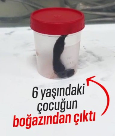 Siirt'te çeşmeden su içen çocuğun boğazına sülük kaçtı
