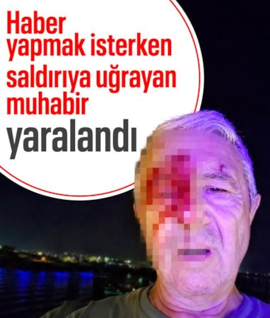 Kocaeli'de haber yapan muhabir saldırıya uğradı