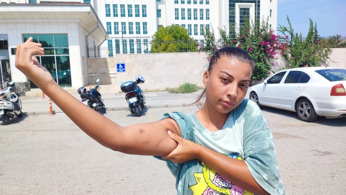 Adana'da cankurtaran kadın, öğretmen amcası tarafından darbedildi